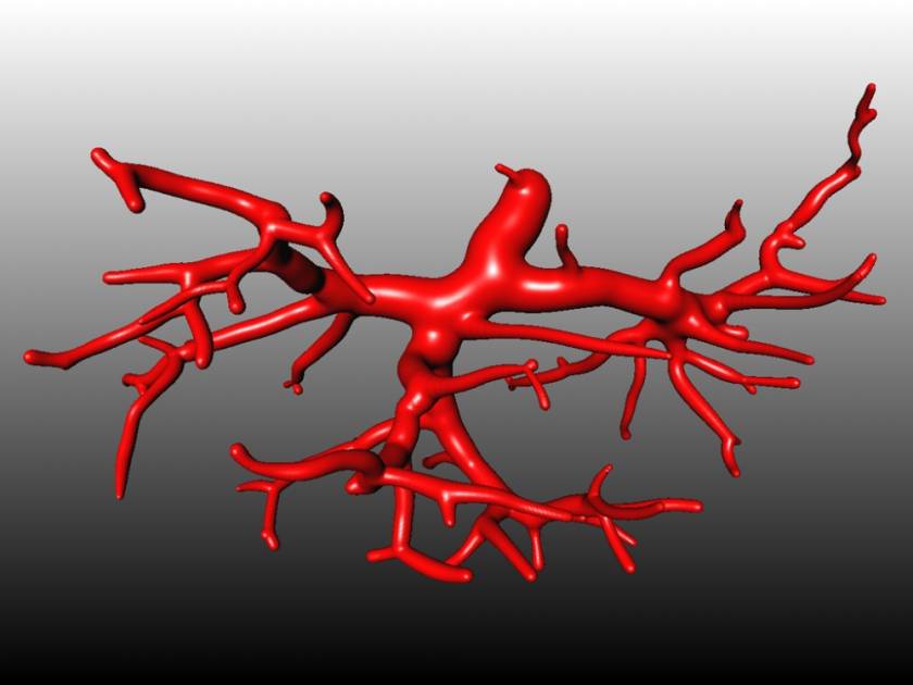 Δημιουργήθηκαν ανθρώπινα αιμοφόρα αγγεία στο εργαστήριο