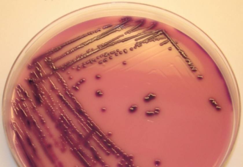 Η γενετική μίξη του E.coli το καθιστά επικίνδυνο