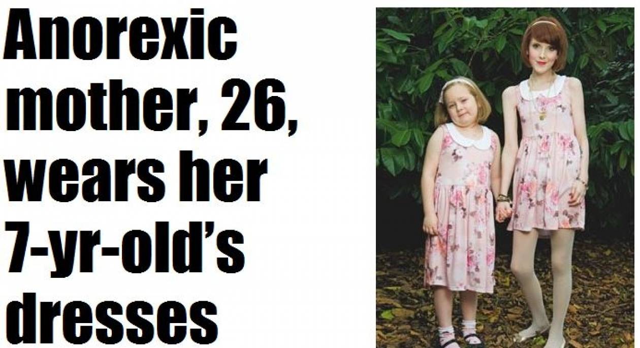 Ανορεξική μητέρα φοράει ίδια ρούχα με την επτάχρονη κόρη της