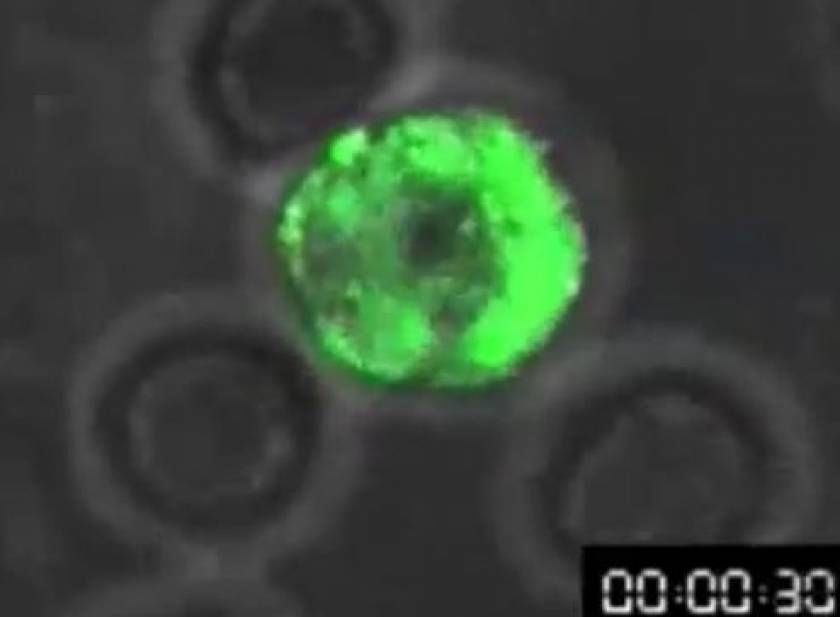 ΒΙΝΤΕΟ: Δείτε πως χτυπά το Aids τα ανθρώπινα κύτταρα
