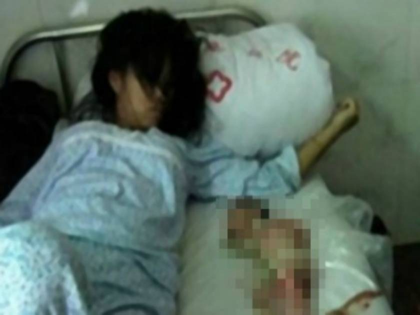 Κίνα: Αποτροπιασμός για την βίαιη άμβλωση σε έγκυο επτά μηνών