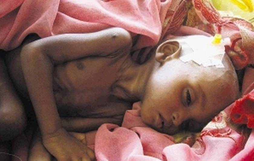 Αφρική: Από λιμό κινδυνεύουν 18 εκατ. άνθρωποι στο Σάχελ