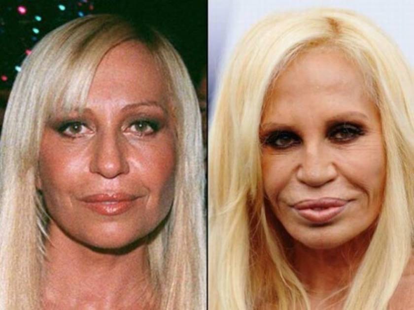 Celebrities πριν και μετά την πλαστική...