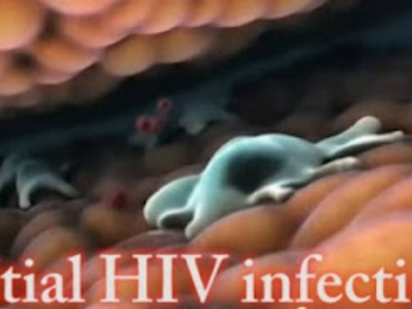 Βίντεο: Δείτε πως χτυπά το AIDS τα ανθρώπινα κύτταρα