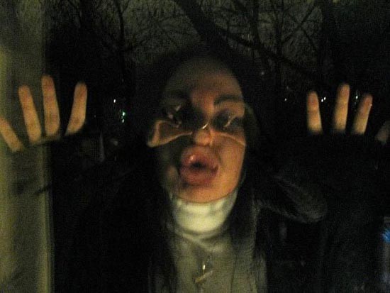 ΣΟΚΑΡΙΣΤΙΚΟ: Άλλη μια κοπέλα που κατέστρεψε το προσωπό της (pics)