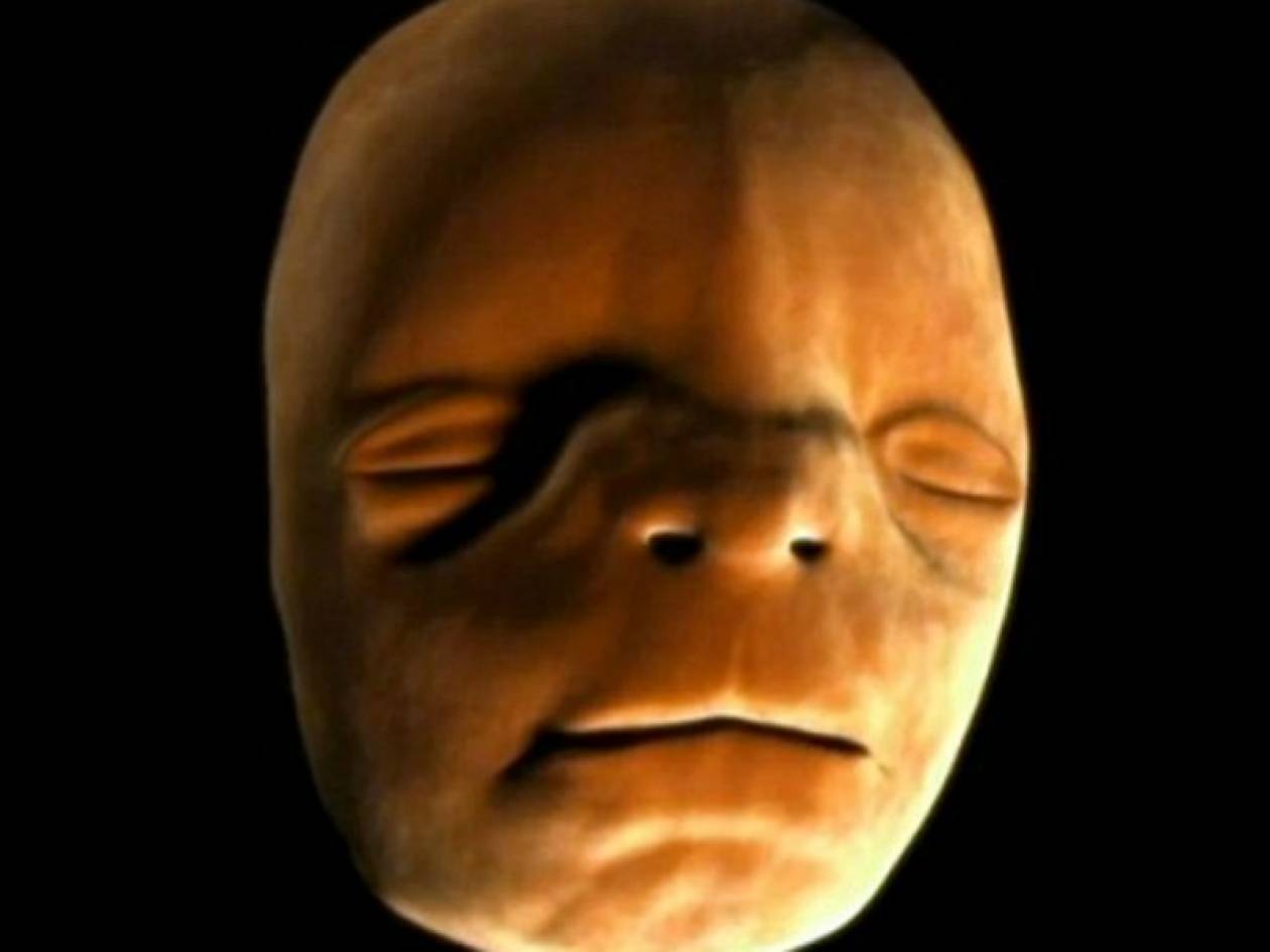 Απίστευτο βίντεο: Πώς διαμορφώνεται το πρόσωπο του εμβρύου στην κοιλιά