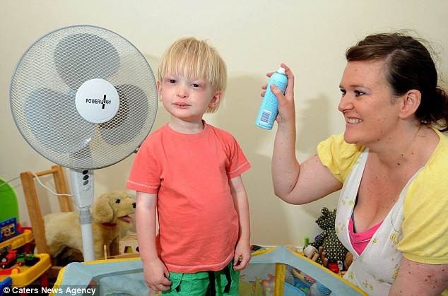 Απίστευτο: Ο 3χρονος που δεν μπορεί να ιδρώσει κινδυνεύει από τη ζέστη