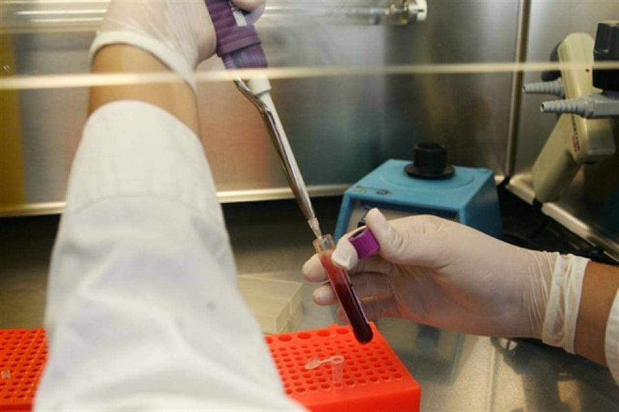 Δωρεάν άλλα 10.000 τεστ για τον ιό του Δυτικού Νείλου