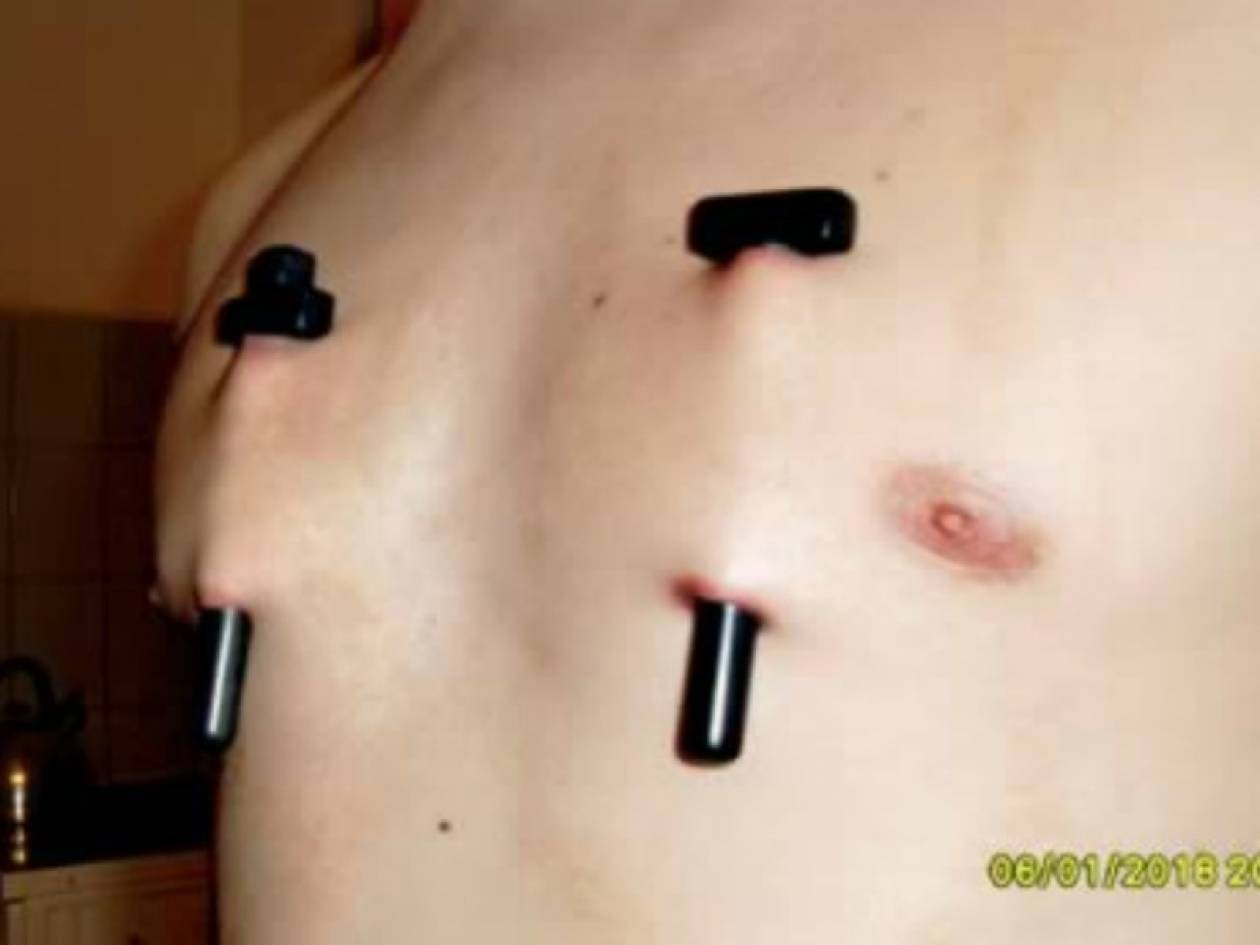 ΣΟΚ: Τα χειρότερα piercing σε ανθρώπινο σώμα