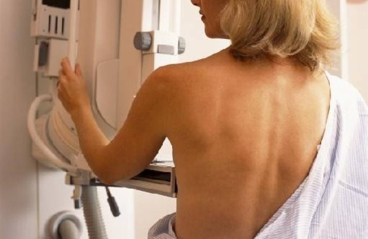 Μαστογραφία στα 35 για πρόληψη καρκίνου