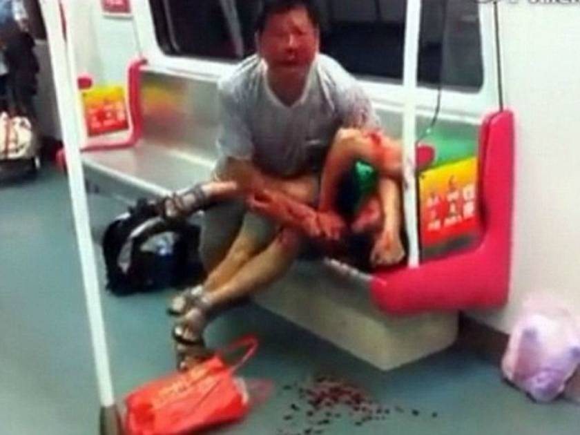 Εικόνες-σοκ: Του επιτέθηκε δαγκώνοντάς τον για μια θέση στο μετρό!