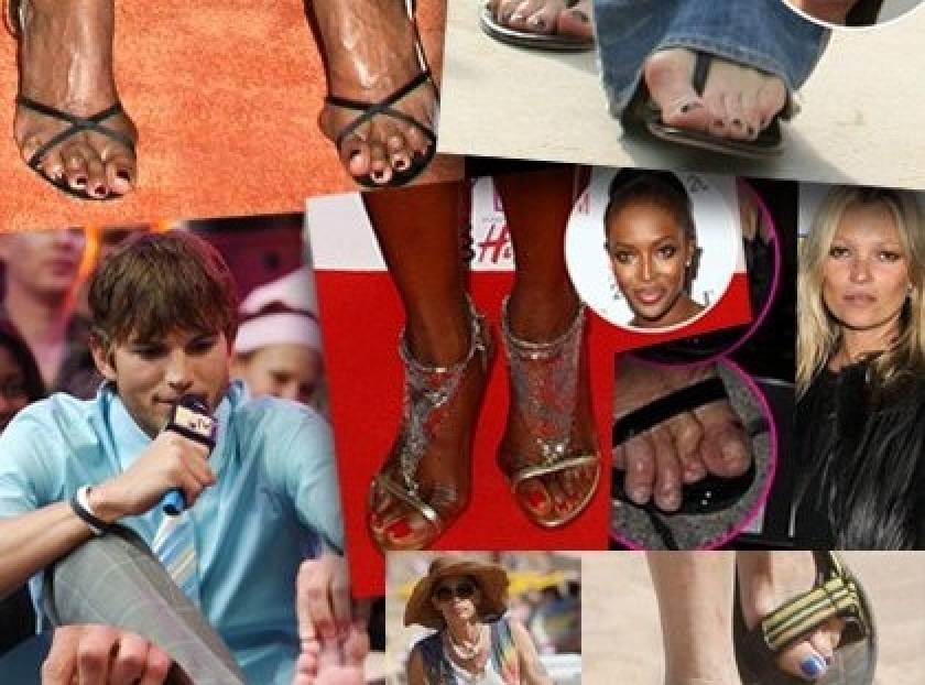 Πλανήτης Hollywood: οι celebrity με τα πιο άσχημα πόδια (φωτό)