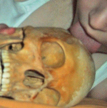 Νέες φωτογραφίες: Η νεκρόφιλη Σουηδή αγκαλιάζει και γλύφει τον σκελετό
