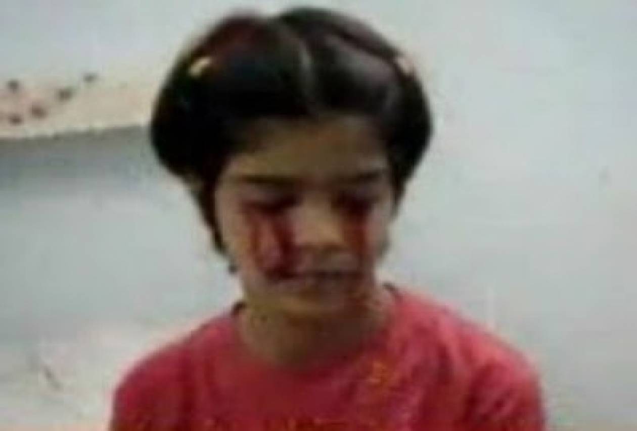 Βίντεο-ΣΟΚ! Κοριτσάκι αντί για δάκρυα βγάζει αίμα