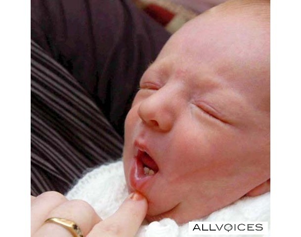 Απίστευτη φωτογραφία: Γεννήθηκε μωρό με… δόντια! 