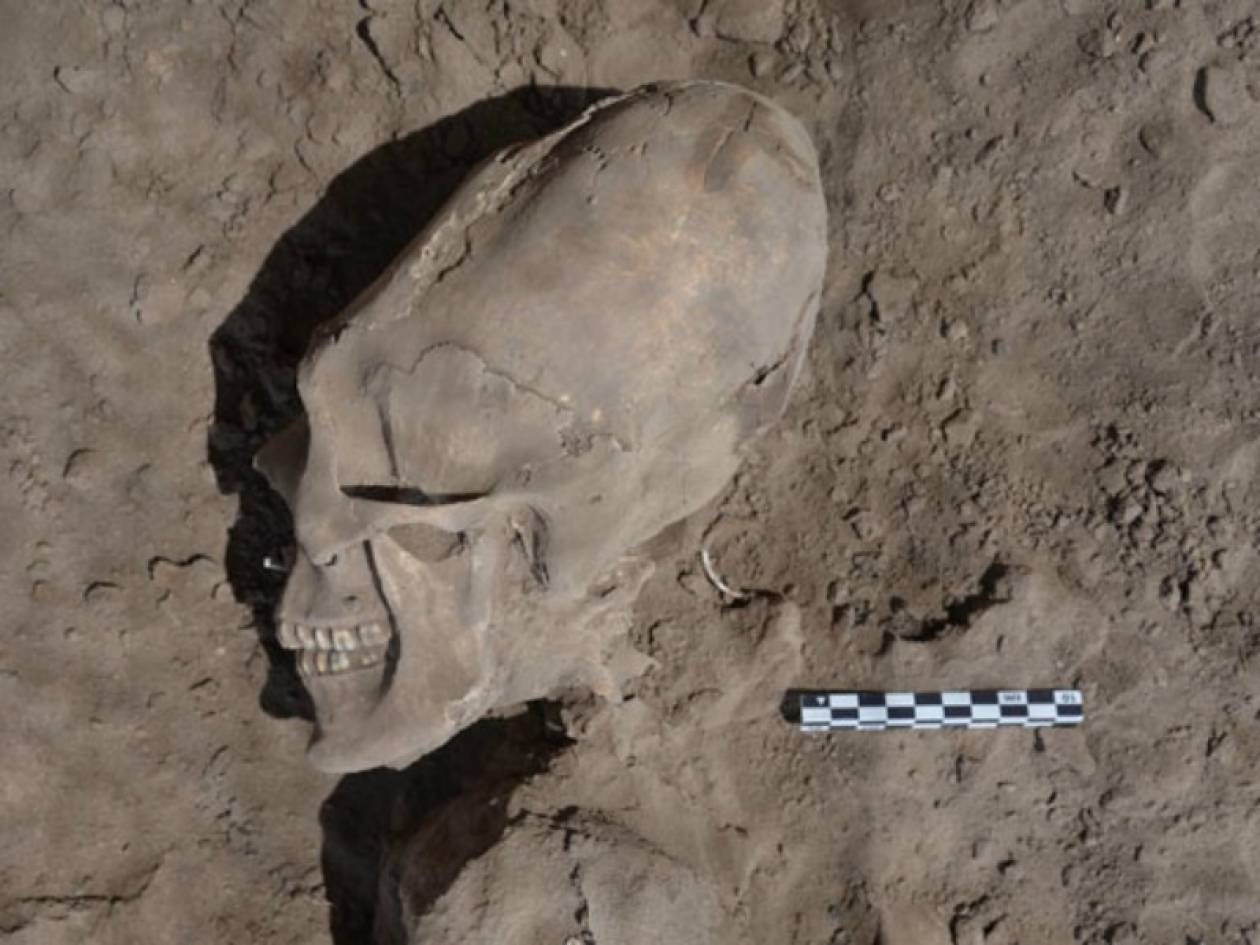 ΒΙΝΤΕΟ - ΣΟΚ: Βρέθηκαν «εξωγήινα» κρανία σε σκελετούς παιδιών