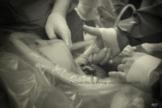 Εκπληκτική φωτογραφία:«Χειραψία» βρέφους με γιατρό την ώρα της γέννας