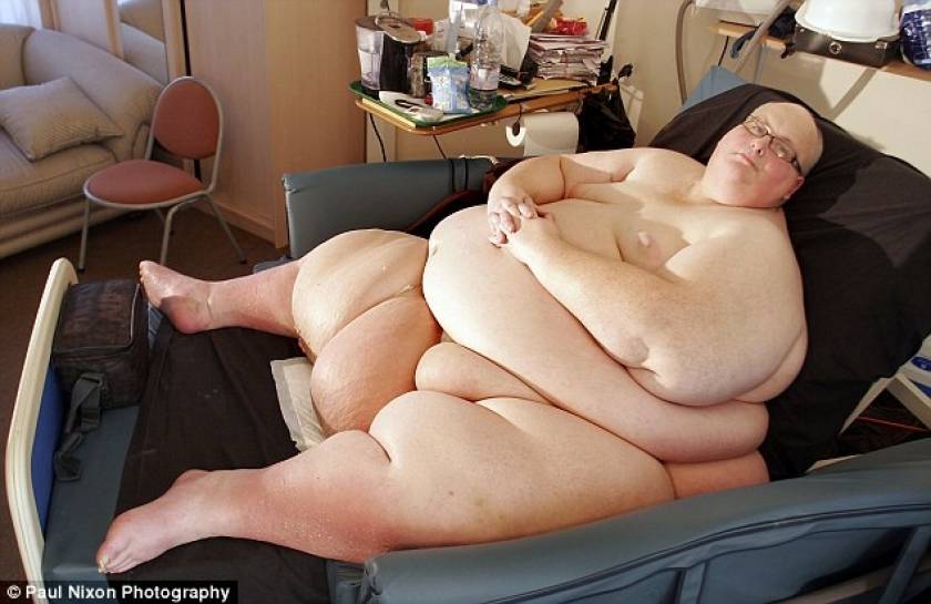 Απίστευτες φωτογραφίες: Έχασε 285 κιλά! Δείτε πως έγινε
