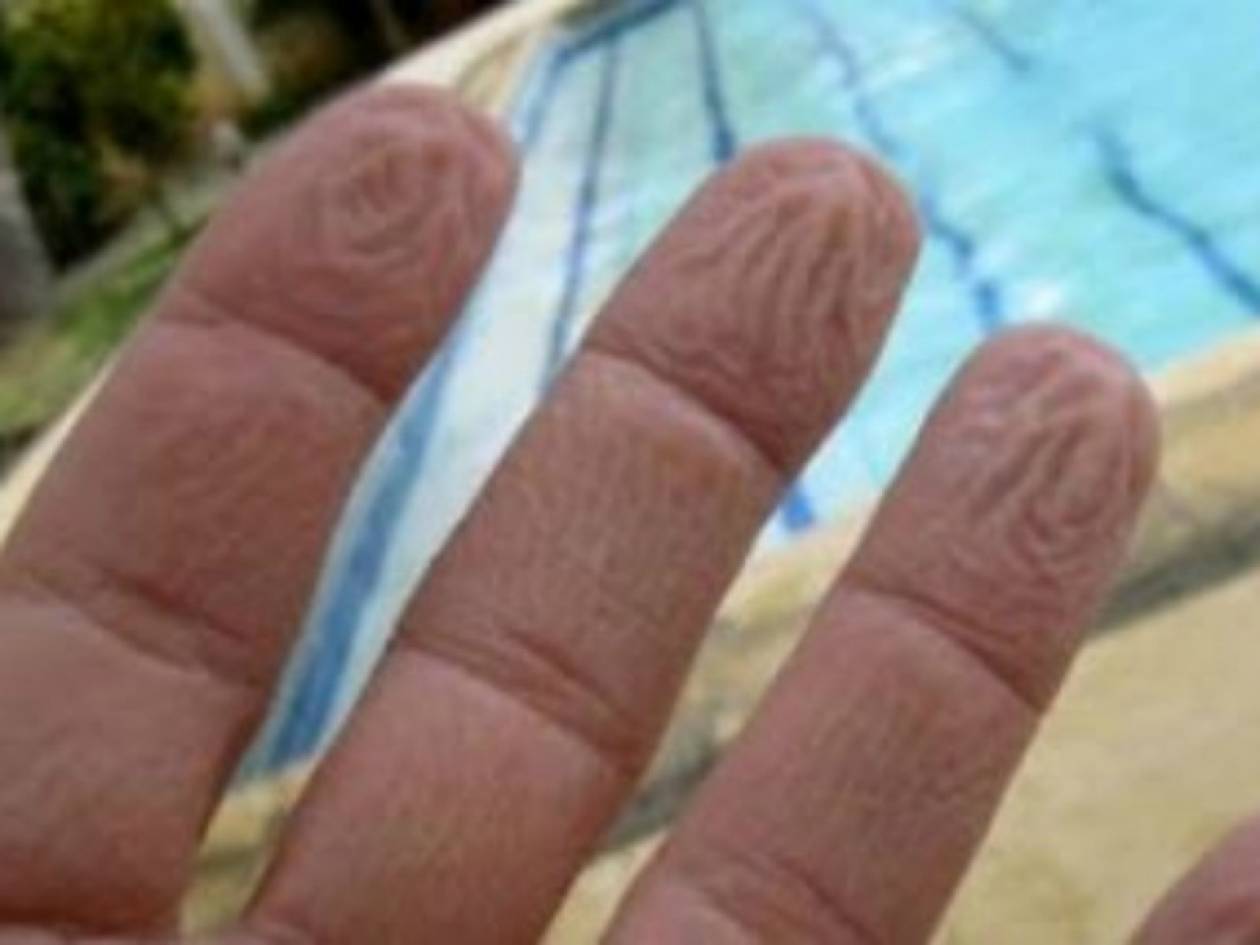 Γιατί τα ανθρώπινα δάχτυλα ζαρώνουν στο νερό;