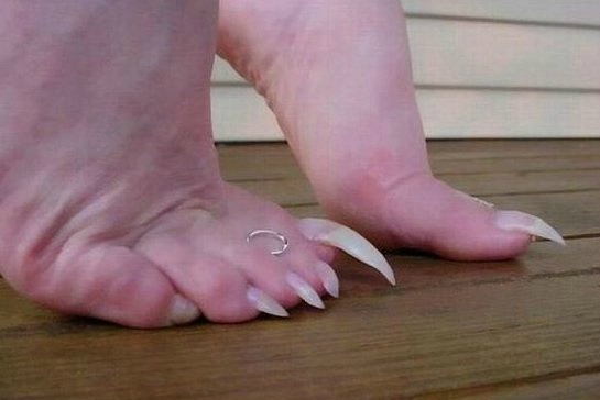 Τα πιο σιχαμένα νύχια ποδιών που έχετε δει στη ζωή σας! (pic)