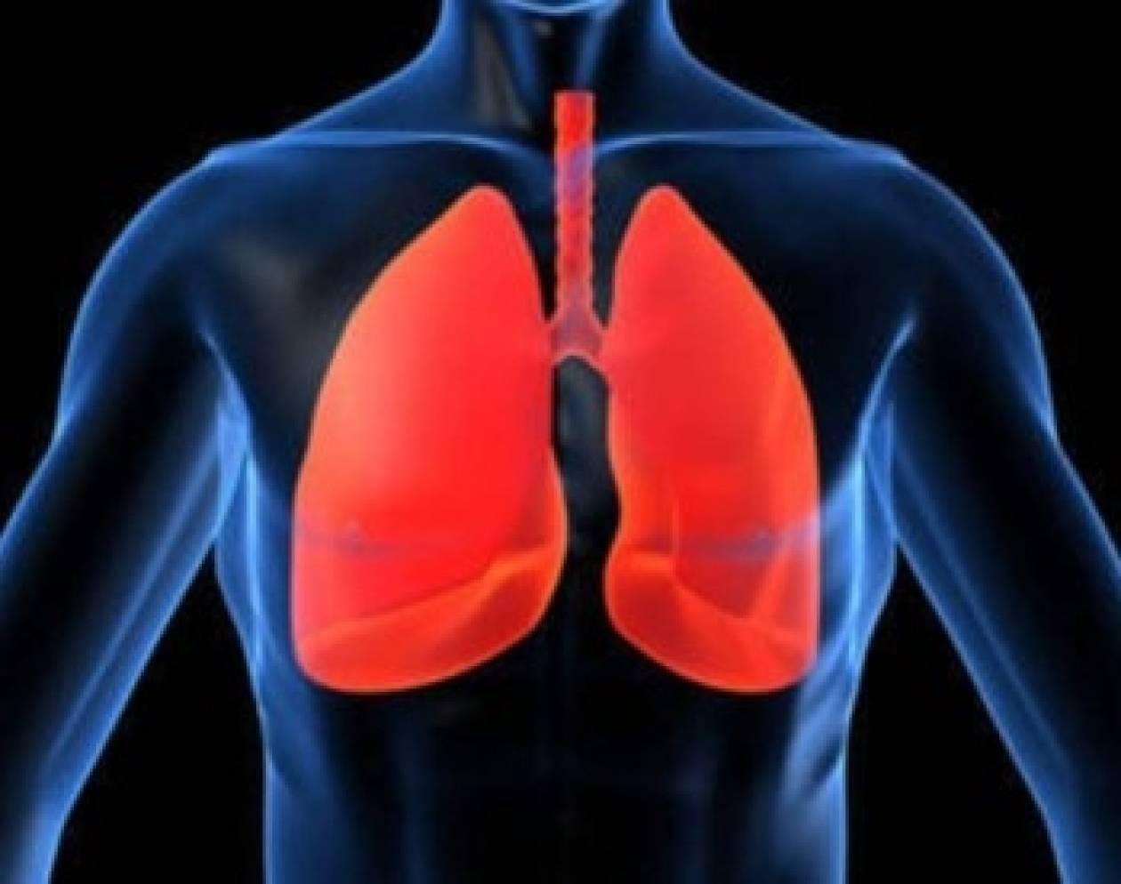 Στην Ιταλία ασθενής για μεταμόσχευση πνευμόνων