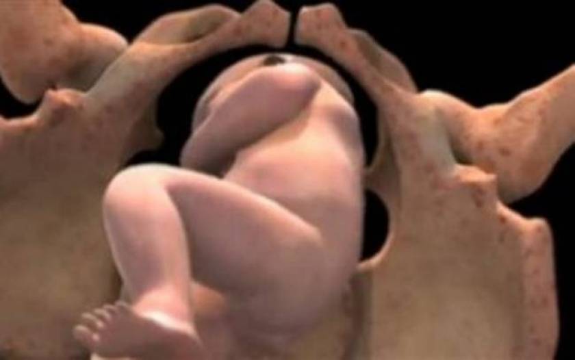 Βρέθηκε έμβρυο στα απόβλητα νοσοκομείου Λεμεσού