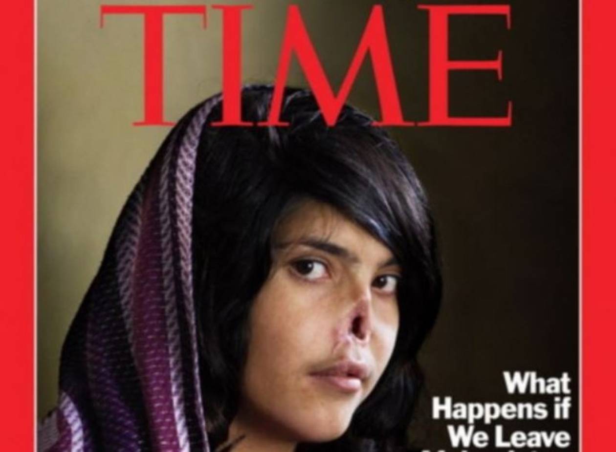 Δείτε την Αφγανή στο εξώφυλλο του Time μετά τις επεμβάσεις