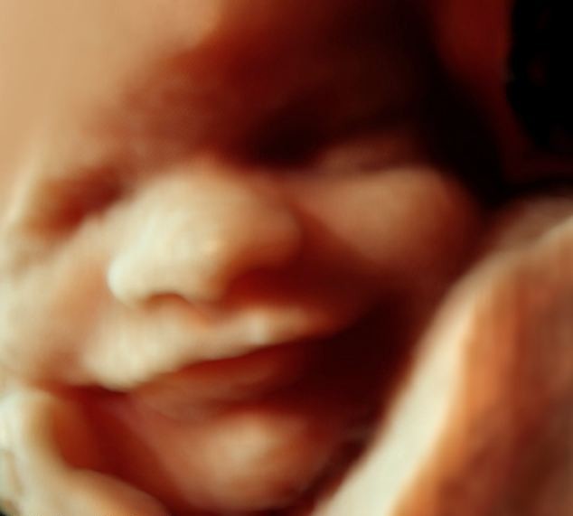 Εντυπωσιακές φωτογραφίες: Έμβρυο χαμογελάει μέσα στη μήτρα