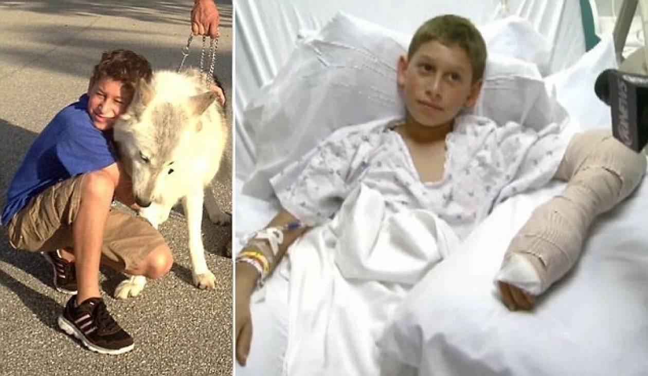 ΣΟΚ: Σκότωσε τον σκύλο του για να βρει το δάκτυλο του γιου του