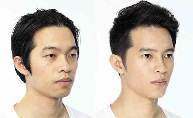 ΔΕΙΤΕ: Κορεάτες πριν και μετά την πλαστική