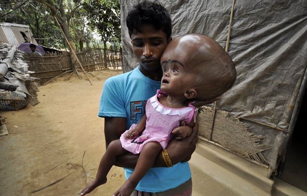 ΣΟΚ: Κοριτσάκι 18 μηνών παγιδευμένο στο γιγαντιαίο κεφάλι του! (pics)