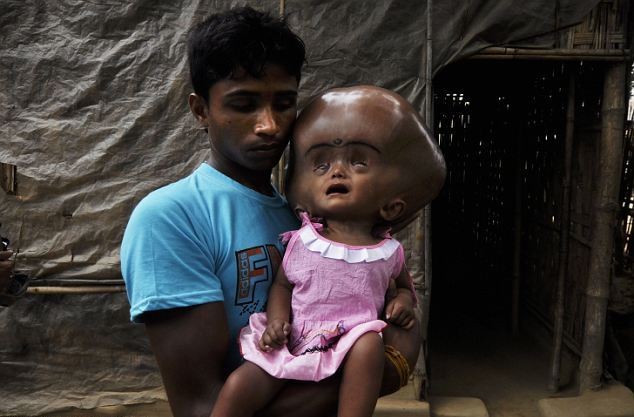 ΣΟΚ: Κοριτσάκι 18 μηνών παγιδευμένο στο γιγαντιαίο κεφάλι του! (pics)