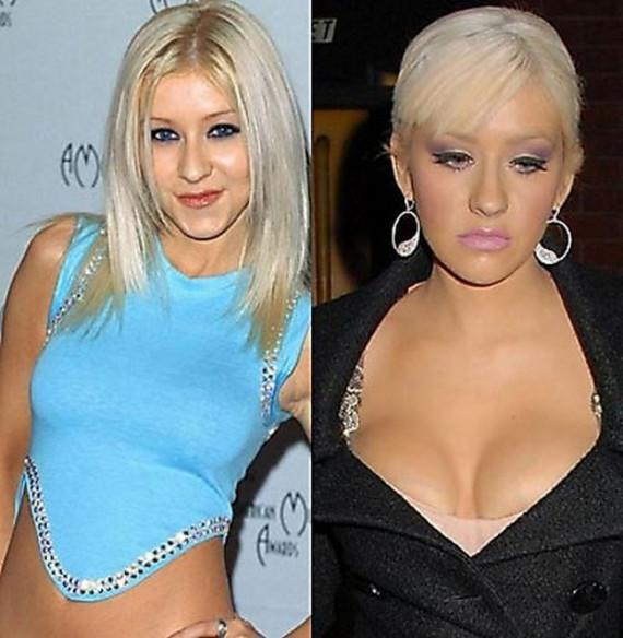 Απίστευτες μεταμορφώσεις:11 διάσημοι πριν και μετά την πλαστική (pics)