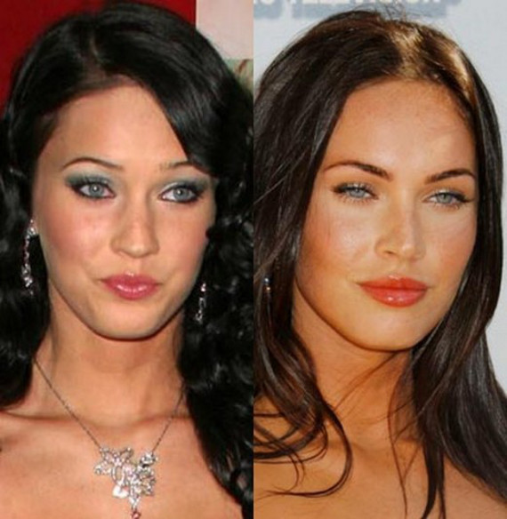 Απίστευτες μεταμορφώσεις:11 διάσημοι πριν και μετά την πλαστική (pics)