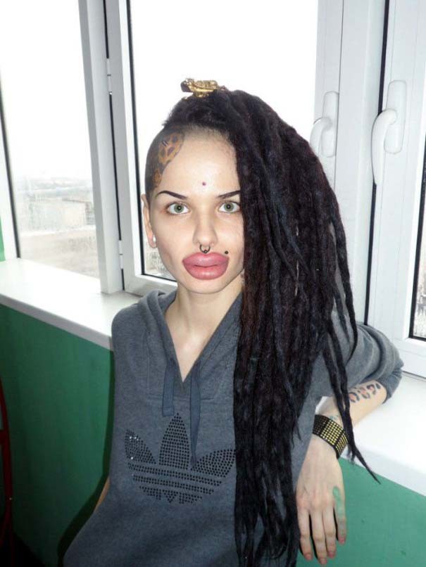 ΕΙΚΟΝΕΣ-ΣΟΚ:Η γυναίκα με τα μεγαλύτερα χείλη στον κόσμο
