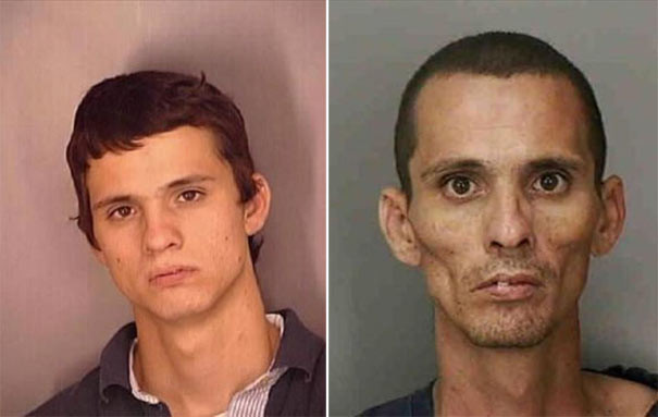 Σοκαριστικές φωτογραφίες ανθρώπων πριν και μετά την χρήση ναρκωτικών  
