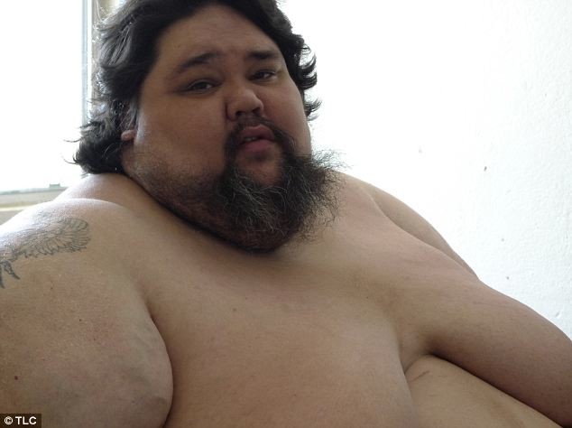 Ένας από τους πιο παχύσαρκους ανθρώπους στον κόσμο-Ζυγίζει 408 κιλά