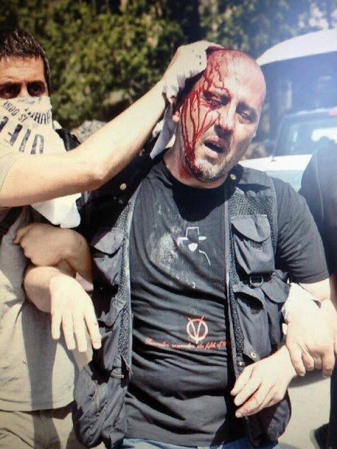 Χωρίς έλεος: Συγκλονιστικές εικόνες από το αιματοκύλισμα στην Τουρκία 