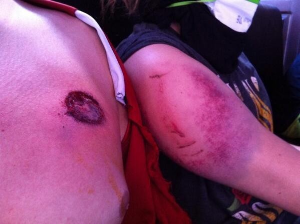 Ρεπόρτερς τραυματίστηκαν από πλαστικές σφαίρες στην πλατεία Ταξίμ-pics