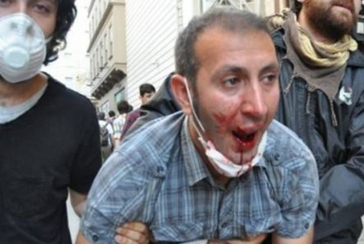 Τούρκος αστυνομικός κλωτσάει στο κεφάλι πεσμένο γυμνό διαδηλωτή (pic)