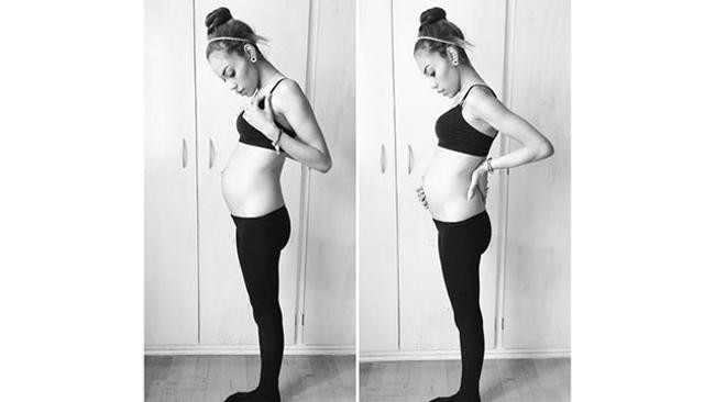 Εικόνες-ΣΟΚ: Έγκυος 8 μηνών ζυγίζει 50 κιλά 