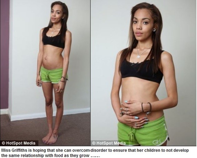Εικόνες-ΣΟΚ: Έγκυος 8 μηνών ζυγίζει 50 κιλά 
