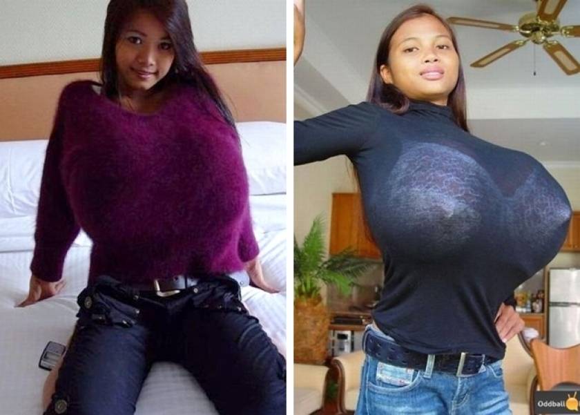 ΔΕΙΤΕ: Αυτή η 16χρονη έχει το μεγαλύτερο στήθος στον κόσμο! (pics)
