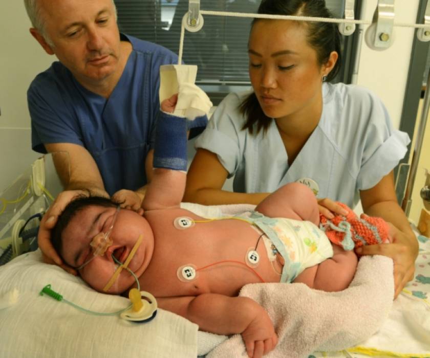 Απίστευτο: Γεννήθηκε γιγαντιαίο βρέφος χωρίς καισαρική