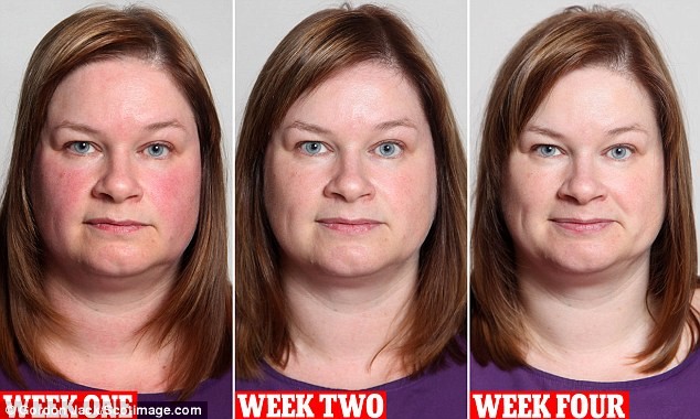 Απίστευτο: Δείτε πώς έγινε σε 1 μήνα μια γυναίκα που σταμάτησε το ποτό