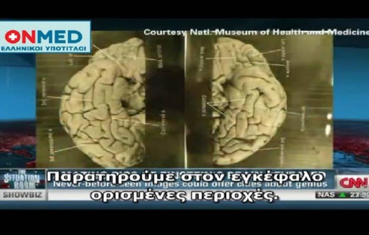 CNN: Εικόνες από τον εγκέφαλο του Αϊνστάιν
