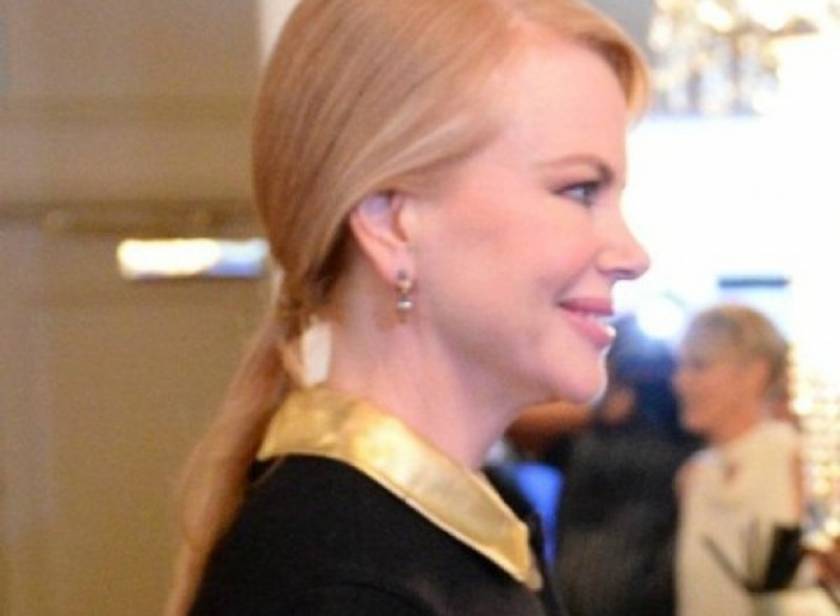 Nicole Kidman: Πέτρωσε το πρόσωπό της από το Botox