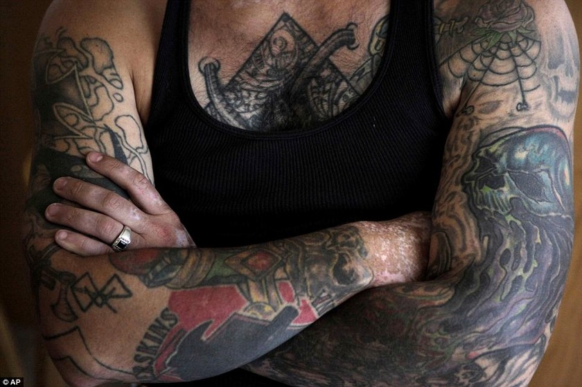 Ρατσιστής αφαιρεί όλα τα ναζιστικά τατουάζ (vid)