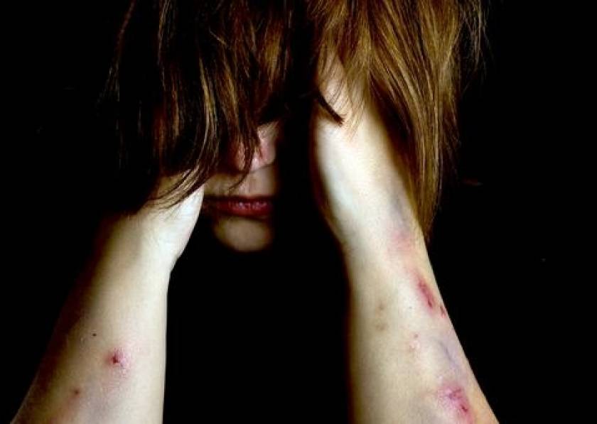 Στοιχεία σοκ: Θύμα ξυλοδαρμού 1 στις 3 γυναίκες