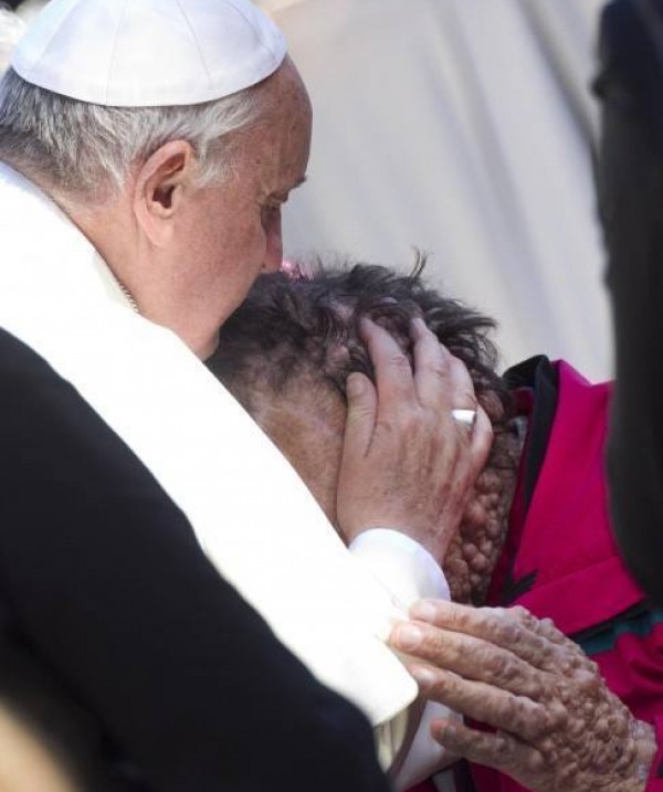 Δείτε τον Πάπα να αγκαλιάζει έναν παραμορφωμένο άνθρωπο (pics)